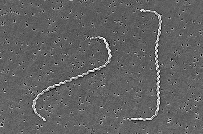 A scanning electrom micrograph of <i>Leptospira interrogans</i>, a spirochete.