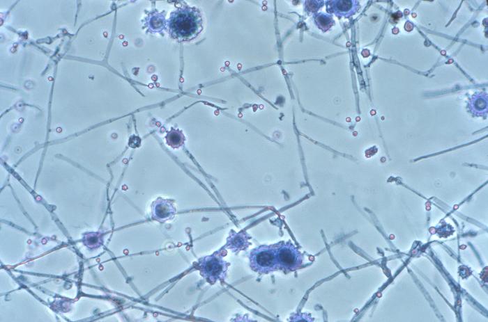 Photomicrograph of the mold phase of <i>Histoplasma 
    capsulatum</i> showing tuberculate macroconidia and microconidia.