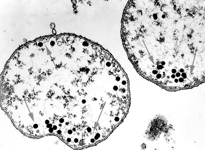 Transmission electronmicrograph of bacteria infected with bacteriophages.