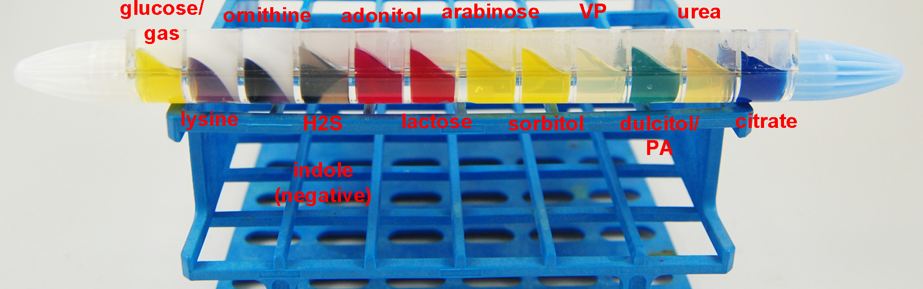 Photograph of your unknown growing in an EnteroPluri Test for Case Study #2 and showing + glucose, - gas, +lysine, + ornithine, + hydrogen sulfide, - indole, - adonitol, - lactose, + arabinose, + sorbitol, - VP, - dulcitol, - PA - urea, and + citrate.