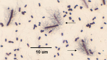 Photomicrograph of a flagella stain of <EM>Proteus</EM> 
    showing peritrichous arrangement of flagella.