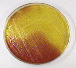 Photograph of <EM>Escherichia coli</EM> 
    growing on XLD agar and showing the production of acid from fermentation of lactose and/or sucrose. This lowers the pH and turns the phenol red from red (alkaline) to yellow (acid). The amino acid 
lysine has not broken down (decarboxylated) so the agar has not turned a deeper red. No hydrogen sulfide production is seen.