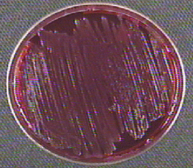 Photograph of <EM> Shigella</EM> 
    growing on XLD agar and showing that neither lactose nor sucrose has been fermented, so no acid is produced. The phenol red remains red. The amino acid 
lysine has not broken down (decarboxylated) so the agar has not turned a deeper red. In addition, hydrogen sulfide production is seen. 