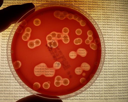 Photomicrograph of a blood agar plate inoculated with <i>Streptococcus pyogenes</i> and showing beta hemolysis.