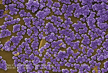 Scanning electron micrograph of Methicillin-Resistant <em>Staphylococcus aureus</em> (MRSA) showing cocci in irregular grape-like clusters.
