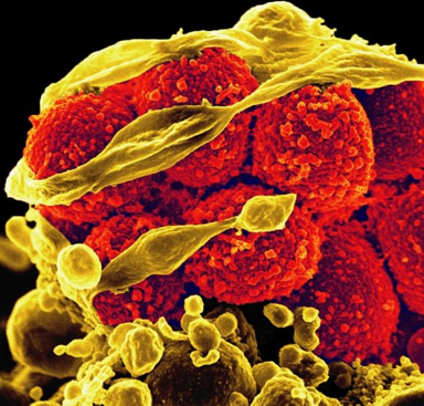 Scanning Electron Micrograph of Methicillin-Resistant <em>Staphylococcus aureus</em> killing an immune cell.