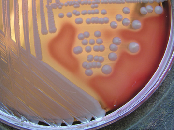 Photograph of <EM>Staphylococcus aureus</EM> growing on blood agar showing no pigment and beta hemolysis