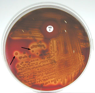 Photograph of <EM>Staphylococcus aureus</EM> growing on blood agar showing gold pigment, beta hemolysis and sensitivity to the novobiocin in the Taxo NB disk.