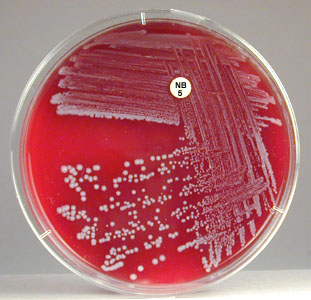 Photograph of <EM>Staphylococcus saprophyticus</EM> growing on blood agar showing no pigment, gamma reaction (no hemolysis) and resistance to the novobiocin in the Taxo NB disk.