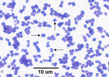 Photomicrograph of <i>Micrococcus luteus</i> showing cocci with a tetrad or sarcina arrangement.