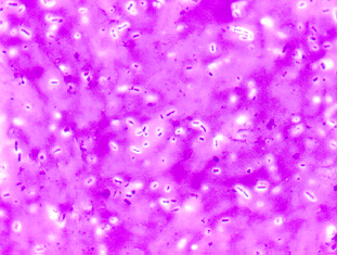 Photomicrograph of a capsule stain of <i>Klebsiella aerogenes</i> showing capsules surrounding the bacillus-shaped bacteria.