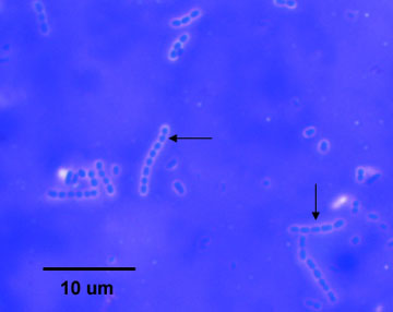 Photomicrograph of a capsule stain of <i>Streptococcus lactis</i> showing capsules surrounding chains of streptococci.