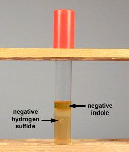 Photograph of a tube of SIM medium showing production of neither indole nor hydrogen sulfide.