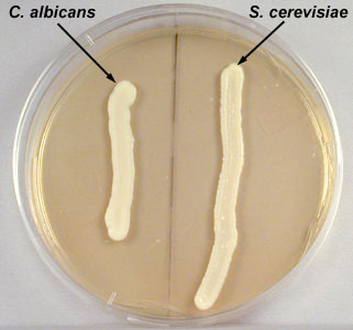 Photograph of <i>Candida albicans</i></EM> 
    and <i>Saccharomyces cerevisiae</i> Growing on SDA.