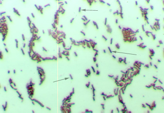 Photograph showing bacillus-shaped bacteria as seen with oil immersion microscopy.