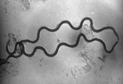 A scanning electron micrograph of <i>Treponema pallidum </i>, a spirochete.