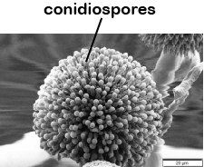 SEM_Aspergillus