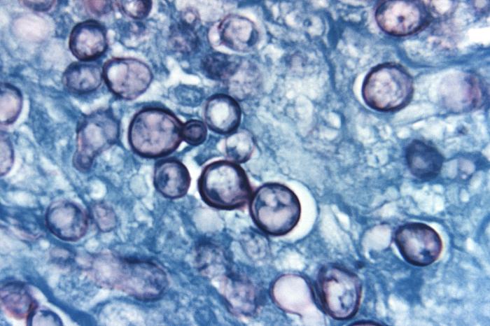 Photomicrograph of the yeast phase of <i>Histoplasma 
    capsulatum</i> in the lung.