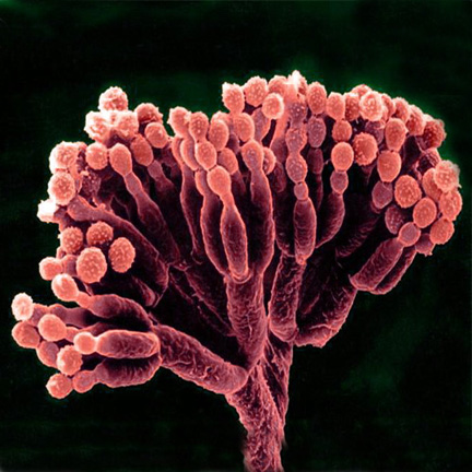 Scanning electronmicrograph showing conidiospores on phialides of the mold <EM>Penicillium</EM>.