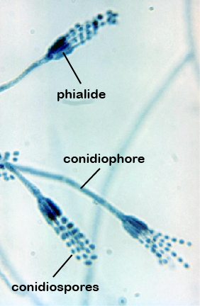 Photomicrograph showing conidiospores on phialides of the mold <EM>Penicillium</EM>.