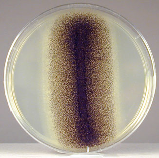 Photograph of <i>Aspergillus</i> growing on Saboraud dextrose agar.