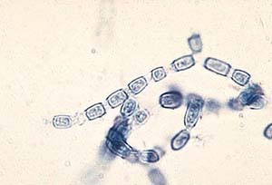 Photomicrograph of arthroconidia being produced by <i>Coccidioides immitis</i>.