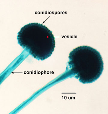 Photomicrograph of conidiospores of <EM>Aspergillus</EM> coming off a  vesicle.