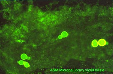 Photomicrograph of the yeast form of <em>Blastomyces dermatitidis</em> in the lung.