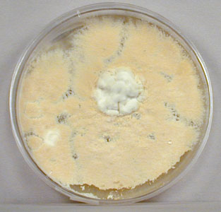 Photograph of the dermatophyte <i>Microsposum</i> 
    growing on Saboraud dextrose agar.