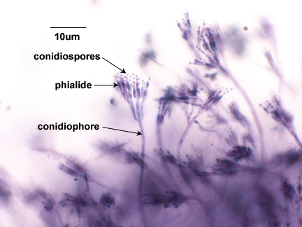 Photomicrograph of conidiospores of <EM>Penicillium</EM> borne on phialides.