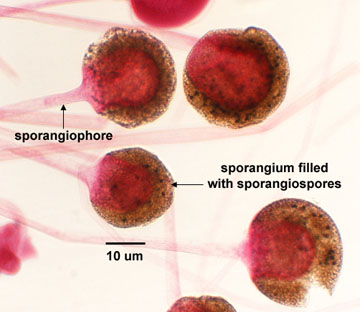 Photomicrograph of sporangiospores of <EM>Rhizopus</EM> within sporangia.