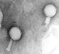 Transmission Electron micrograph of a bacteriophage 
    with a contractile sheath.