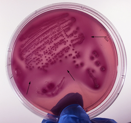 Photograph of <EM>Escherichia coli</EM> 
    growing on MacConkey agar showing strong fermentation of lactose.