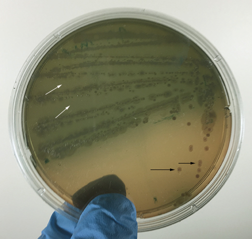 Photograph of <EM>Pseudomonas aeruginosa</EM> 
    growing on MacConkey agar showing no fermentation of lactose. as well as its green, water-soluble pigment.