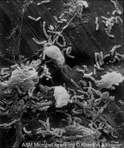 Scanning electron micrograph of 
    <em>Pseudomonas aeruginosa</em> colonizing a vascular catheter.
