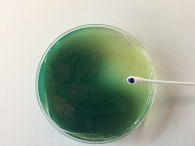 Photograph of  <i>Pseudomonas 
    aeruginosa</i> growing on Cetrimide agar showing the production of pyocyanin, 
  a green water soluble pigment, as well as a positive  oxidase test.