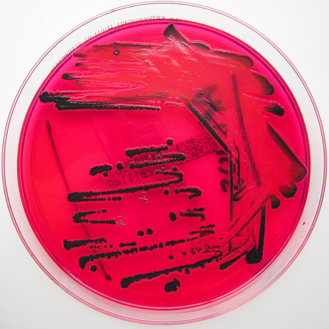 Photograph of <EM>Salmonella</EM> 
    growing on XLD agar and showing neither lactose nor sucrose being fermented so that no acid is produced and the phenol red remains red. The amino acid 
  lysine has been broken down (decarboxylated) producing alkaline end products which has caused the phenol red in the agar to turn a deeper red. In addition, hydrogen sulfide production has caused some of the colonies to appear black.