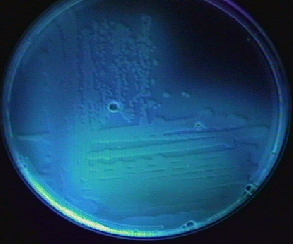 Photograph of <i>Pseudomonas aeruginosa</i> 
    growing on Cetrimide agar and fluorescing under ultraviolet light.