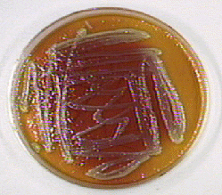Photograph of <EM> Enterobacter cloacae</EM> 
    growing on XLD agar and showing acid produced from the fermentation of lactose and/or sucrose, thus lowering the pH and turning the phenol 
red from red (alkaline) to yellow (acid). In addition, breakdown of the amino 
acid lysine has produced alkaline end products which raises the pH and has causing some 
of the agar to turn a deeper red. No hydrogen sulfide production is seen.