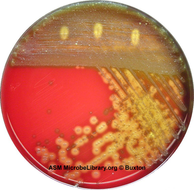 Photograph of A blood agar plate from  
    a throat culture showing possible <em>Streptococcus pyogenes</em> infection.