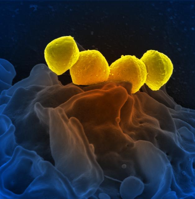 Scanning Electron Micrograph of <i>Streptococcus 
    pyogenes </i> showing a chain of four cocci.
