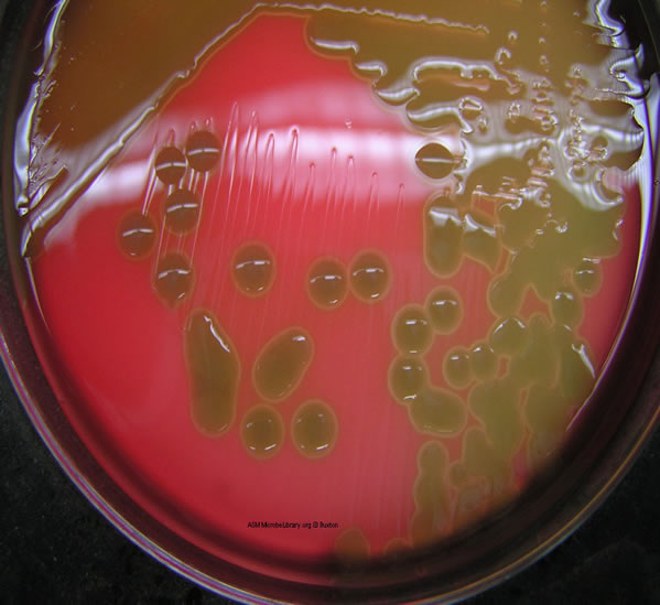 Photograph of <em>Streptococcus pneumoniae</em> 
    on blood agar showing mucoid colonies and alpha hemolysis.