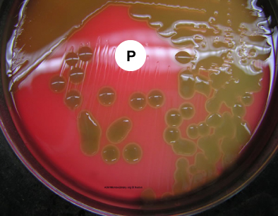 Photograph of <i>Streptococcus pneumoniae</i> 
    growing on blood agar with a Taxo P disc showing alpha hemolysis and sensitivity to the optochin in the Taxo P disk.