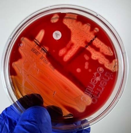 Photograph of a blood agar plate inoculated with <i>Streptococcus pyogenes</i> showing small, white opaque colonies, beta hemolysis (complete lysis of the red 
  blood cells around the colonies), and sensitivity to the antibiotic 
  bacitracin in the Taxo A disk.