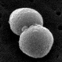 Scanning Electron Micrograph of 
    <i>Streptococcus pneumoniae</i> showing a diplococcus.