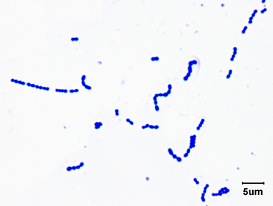 Photomicrograph of a Gram stain of <EM>Streptococcus 
    pyogenes</EM> showing Gram-positive cocci in chains.