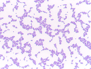 Photomicrograph of a Gram stain of <EM>Staphylococcus 
    aureus</EM> showing Gram-positive cocci in irregular grape-like clusters.