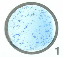 Photograph of a positive Staphyloslide® Test on <EM>Staphylococcus 
    aureus</EM> showing clumping of the latex particles.