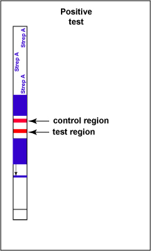 Illustration of a positive test for Group A <i>Streptococcus</i> antigen showing a red band in both the test region and the  control region of the test strip.
