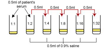 Illustration showing how to dilute the patient's serum in a quantitative RPR card test.